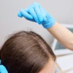 Female Hair Transplant in Dubai