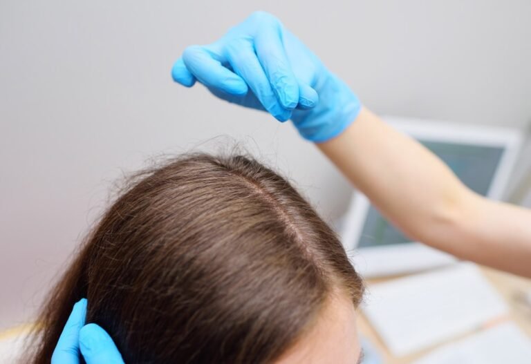 Female Hair Transplant in Dubai
