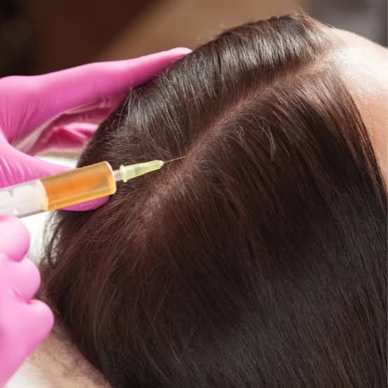 mesotherapy for hair