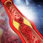 best angiography hospital near me
