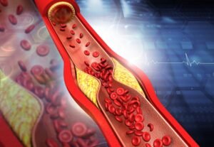 best angiography hospital near me