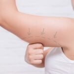 Arm Lift Surgery in Dubai Top Clinic Choices Explained