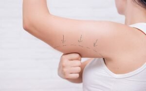Arm Lift Surgery in Dubai Top Clinic Choices Explained