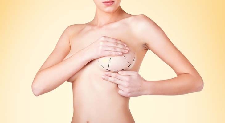Breast Augmentation in Dubai: How to Achieve Natural-Looking Results