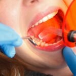 Dental Aligners Cost: Clear Aligner Prices & Treatment Details