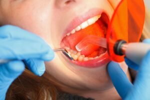Dental Aligners Cost: Clear Aligner Prices & Treatment Details