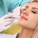 Dermal Fillers in Dubai