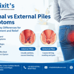 Internal vs External Piles Symptoms