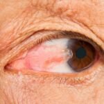 eye LASIK near me