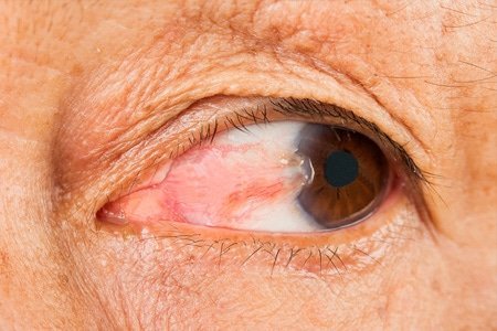 eye LASIK near me