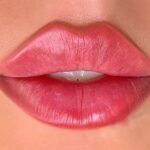 What Are Russian Lip Fillers and How Do They Work