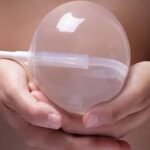 Where to Get Allurion Gastric Balloon in Dubai Top Clinics