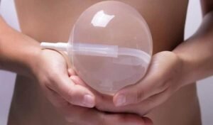 Where to Get Allurion Gastric Balloon in Dubai Top Clinics