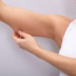 Which Is the Best Clinic for Arm Lift Surgery in Dubai