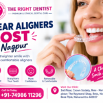 clear aligners cost nagpur
