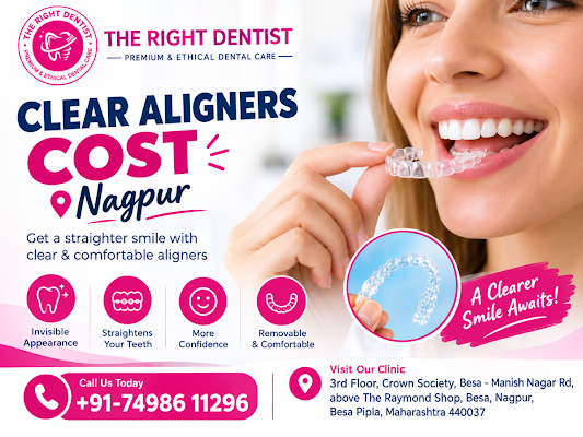 clear aligners cost nagpur