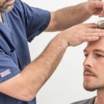 Robotic Hair Transplant in Dubai