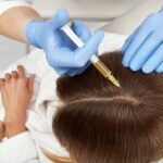 Female Hair Transplant in Dubai