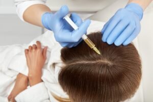 Female Hair Transplant in Dubai