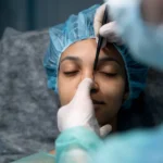 facial-trauma