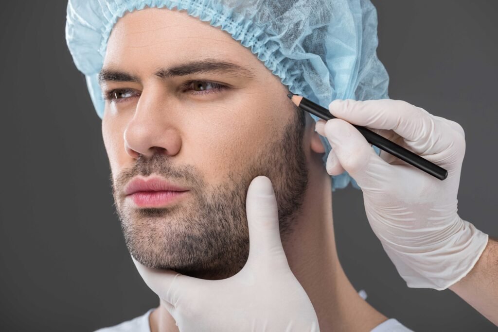 Beard Hair Transplant in Dubai