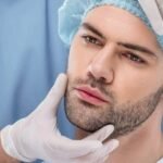 Beard Hair Transplant in Dubai