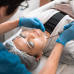 Can Picosure Laser Treatment Remove Sun Damage