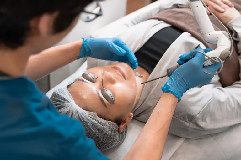 Can Picosure Laser Treatment Remove Sun Damage