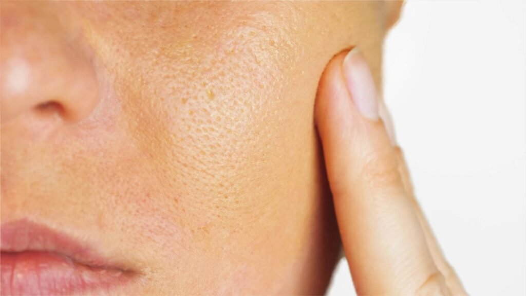 Large Pores Treatment Cost Pricing Guide for Popular Procedures