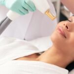 Laser Treatment in Dubai