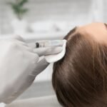 PRP For Hair Treatment in Dubai