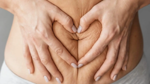 What Makes Our Clinic a Trusted Choice for Mommy Makeover Surgery