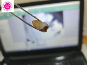 dental clinic near manish nagar